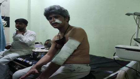 Ganosanghati Andolan Coordinator Zonayed Saki after the attack on Tuesday (7 June). Photo: Collected