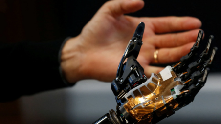COVVI Group CEO Simon Pollard holds the bionic hand developed by COVVI, at Quayside Business Park in Leeds, Britain August 11, 2022. REUTERS/Craig Brough