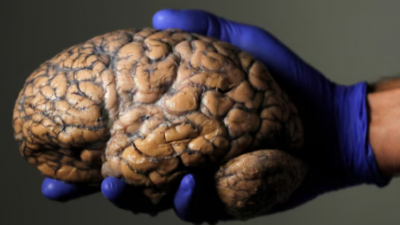 A researcher holds a human brain, part of a collection of more than 3,000 brains at the psychiatric hospital in Duffel, Belgium, July 19, 2017. REUTERS/Yves Herman