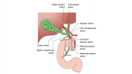 The Surgical Jaundice: What a patient should know