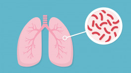 Bangladesh struggles to achieve 2035 tuberculosis elimination goal