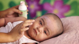 A surge of measles cases has led to a growing influx of infected children at DNCC Covid-19 Dedicated Hospital in Mohakhali, with new patients arriving daily, many of them referred from other hospitals and mostly children. Photo taken on 8 April 2026. Photos: Mehedi Hasan/TBS 
